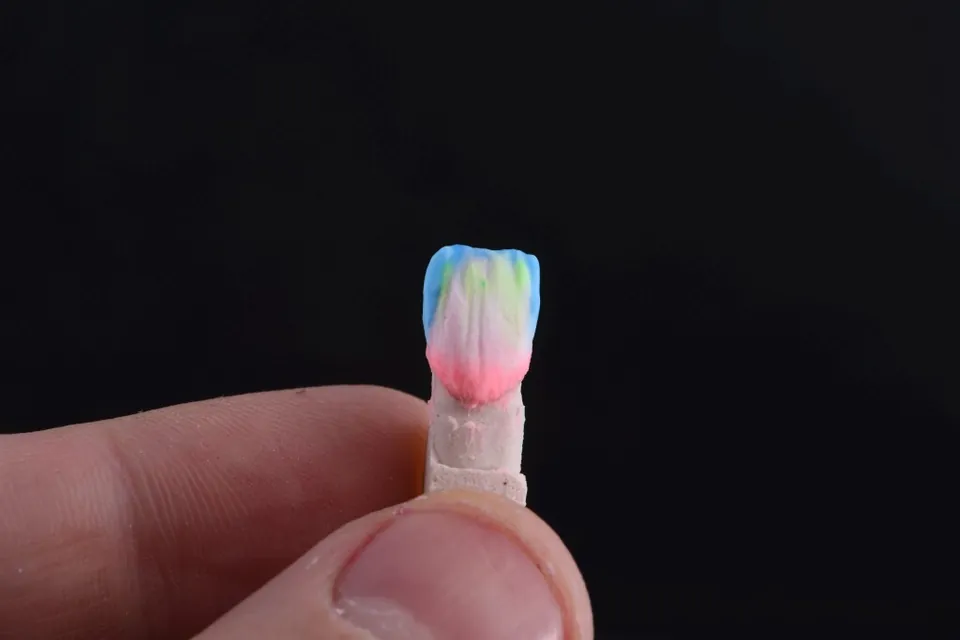 A single hand-layered porcelain veneer during the build — layered color before firing