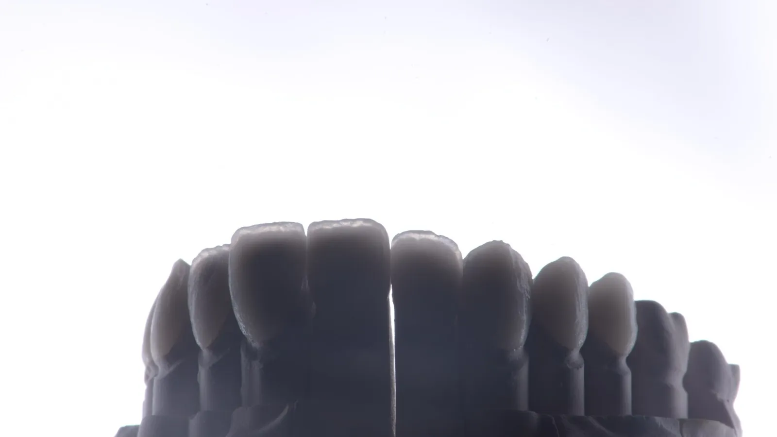 Backlit dental stone model of upper teeth against a white background