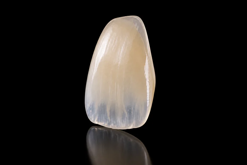 Render of a hand-layered porcelain veneer