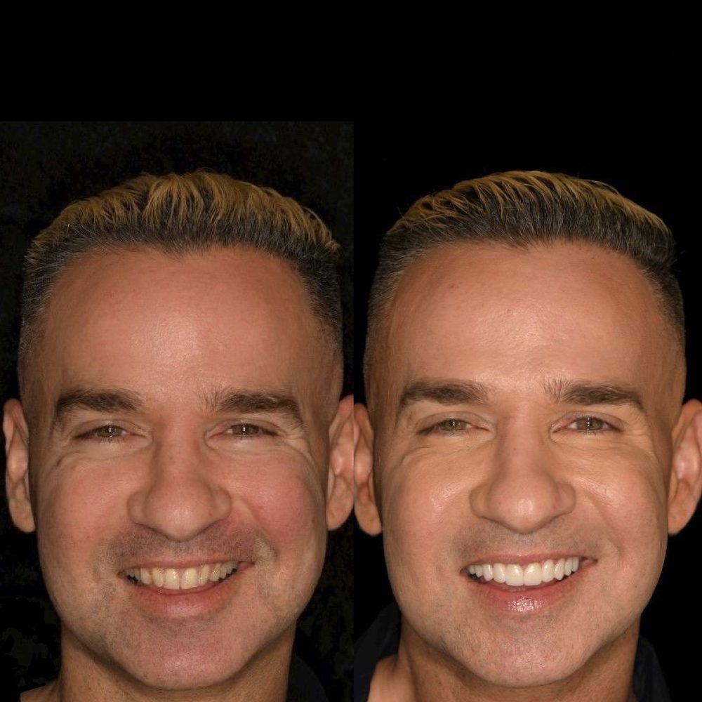 Mike
